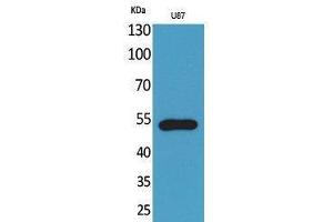 Western Blotting (WB) image for anti-Chemokine (C-X3-C Motif) Receptor 1 (CX3CR1) (Internal Region) antibody (ABIN3178143) (CX3CR1 抗体  (Internal Region))