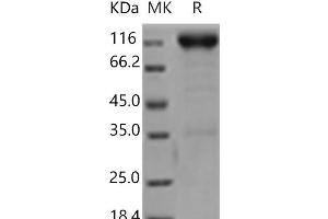 Western Blotting (WB) image for Platelet Derived Growth Factor Receptor beta (PDGFRB) (Active) protein (Fc Tag) (ABIN7197400) (PDGFRB Protein (Fc Tag))