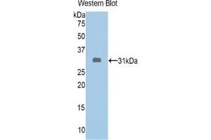 Detection of Recombinant ABCA1, Human using Polyclonal Antibody to ATP Binding Cassette Transporter A1 (ABCA1) (ABCA1 抗体  (AA 1404-1663))
