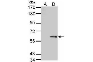 WB Image Western Blot analysis of FPGS expression in transfected 293T cell line by FPGS polyclonal antibody. (FPGS 抗体)