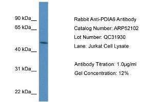 WB Suggested Anti-PDIA6 Antibody Titration: 0. (PDIA6 抗体  (N-Term))