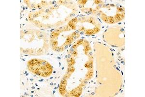 Immunohistochemistry (Paraffin-embedded Sections) (IHC (p)) image for anti-Cytochrome P450, Family 20, Subfamily A, Polypeptide 1 (CYP20A1) antibody (ABIN7073675)