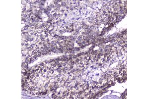 Immunohistochemistry (IHC) image for anti-ClpP Caseinolytic Peptidase, ATP-Dependent, Proteolytic Subunit Homolog (E. Coli) (CLPP) (AA 184-247) antibody (ABIN5693176)