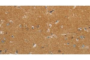 Immunohistochemistry of paraffin-embedded Human brain using GJB6 Polyclonal Antibody at dilution of 1:30 (GJB6 抗体)