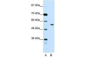 WB Suggested Anti-BRD3  Antibody Titration: 2. (BRD3 抗体  (N-Term))