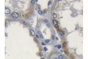 Detection of APOL2 in Human Kidney Tissue using Polyclonal Antibody to Apolipoprotein L2 (APOL2)