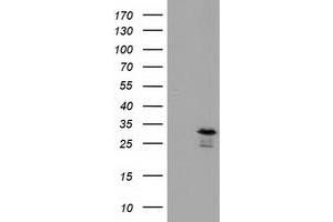 Western Blotting (WB) image for anti-RASD Family, Member 2 (RASD2) antibody (ABIN1500696) (RASD2 抗体)