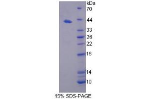 SDS-PAGE analysis of Mouse NCOR1 Protein. (NCOR1 蛋白)