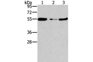 Western Blot analysis of Mouse heart tissue and NIH/3T3 cell, Mouse liver tissue using FGFR1OP Polyclonal Antibody at dilution of 1:850 (FGFR1OP 抗体)