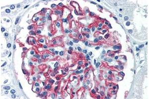 Human Kidney (formalin-fixed, paraffin-embedded) stained with CR1 antibody ABIN337278 at 10 ug/ml followed by biotinylated anti-mouse IgG secondary antibody ABIN481714, alkaline phosphatase-streptavidin and chromogen. (CD35 抗体)