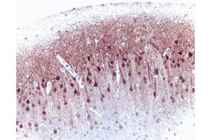 ERK 2 (clone 33) staining on rat brain. (ERK2 抗体  (AA 219-358))