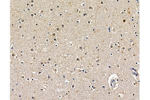 ABIN7097016 and ABIN7101083 at 1/100 staining mouse brain tissue by IHC-P. (POU6F2 抗体)