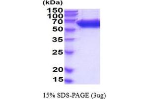 ALPL Protein (AA 19-503) (His tag)