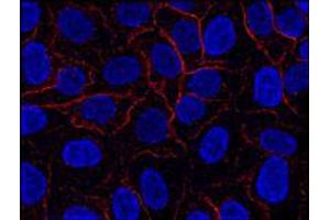 Immunofluorescence (IF) image for anti-AHNAK Nucleoprotein (AHNAK) (N-Term) antibody (ABIN263928) (AHNAK 抗体  (N-Term))