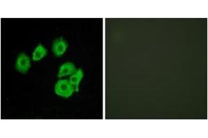 Immunofluorescence analysis of HuvEc cells, using CLTR1 Antibody. (CysLTR1 抗体  (AA 131-180))