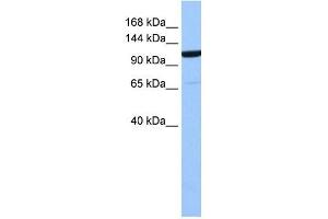 NUP155 antibody used at 1 ug/ml to detect target protein.
