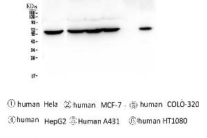 Western blot analysis of TCP1 alpha using anti-TCP1 alpha antibody . (TCP1 alpha/CCTA 抗体  (C-Term))