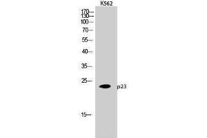 Western Blotting (WB) image for anti-Cyclin-Dependent Kinase 5, Regulatory Subunit 1 (p35) (CDK5R1) (Tyr579) antibody (ABIN3180222) (CDK5R1 抗体  (Tyr579))