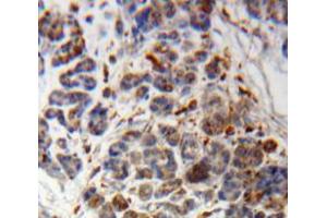 Used in DAB staining on fromalin fixed paraffin-embedded Pancreas tissue (PIK3C2A 抗体  (AA 349-611))