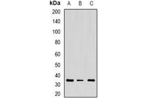 Western blot analysis of CD272 expression in mouse spleen (A), mouse thymus (B), rat lung (C) whole cell lysates. (BTLA 抗体)