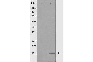 Western blot analysis of extracts of HeLa  using H3R8me2s antibody. (Histone 3 抗体  (H3R8me2))