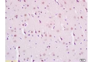 Formalin-fixed and paraffin embedded rat brain labeled with Anti-Phospho-SIRT1(Ser47) Polyclonal Antibody, Unconjugated (ABIN745658) at 1:200 followed by conjugation to the secondary antibody and DAB staining (SIRT1 抗体  (pSer47))