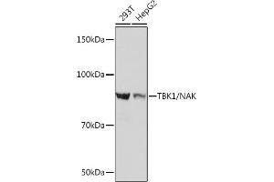 Western blot analysis of extracts of various cell lines, using TBK1/NAK Rabbit mAb (ABIN7270723) at 1:1000 dilution. (TBK1 抗体)