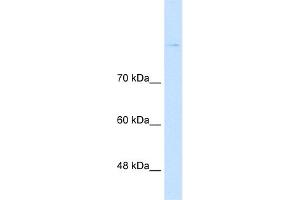 Host:  Rabbit  Target Name:  CDH8  Sample Type:  Jurkat  Antibody Dilution:  1. (Cadherin 8 抗体  (Middle Region))