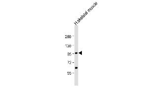 Anti-YY1 Antibody (Center)at 1:2000 dilution + human skeletal muscle lysates Lysates/proteins at 20 μg per lane. (YY1AP1 抗体  (AA 437-468))