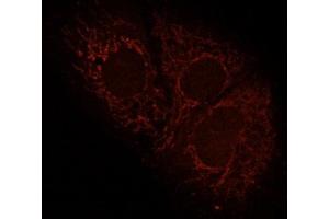Human HepG2 cells fixed with 3. (IMMT 抗体  (AA 241-340))