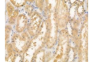 ABIN6261397 and ABIN6279385 at 1/100 staining human normal kidney tissue by IHC-P.