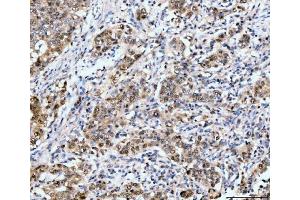 IHC analysis of Neurofibromin/NF1 using anti-Neurofibromin/NF1 antibody (ABIN7600196). (Neurofibromin 1 抗体  (AA 160-270))