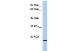 Image no. 1 for anti-RWD Domain Containing 4 (RWDD4) (C-Term) antibody (ABIN6743711) (RWDD4A 抗体  (C-Term))