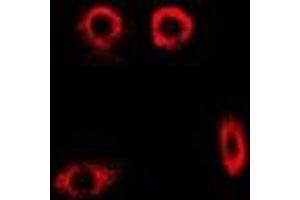 Immunofluorescent analysis of PYGL staining in MCF7 cells. (PYGL 抗体)