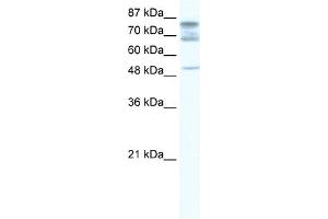 WB Suggested Anti-DDX46 Antibody Titration:  1.