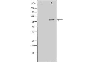 Western blot analysis of Hela whole cell lysates, using DCLRE1C Antibody. (DCLRE1C 抗体  (C-Term))