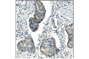 IHC analysis of ANGPT2 using anti-ANGPT2 antibody (ABIN7601450). (Angiopoietin 2 抗体  (AA 357-404))