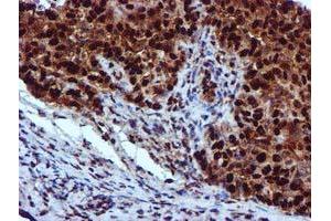 Image no. 5 for anti-EPM2A (Laforin) Interacting Protein 1 (EPM2AIP1) antibody (ABIN1498045) (EPM2AIP1 抗体)