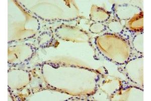 Immunohistochemistry of paraffin-embedded human thyroid tissue using ABIN7161681 at dilution of 1:100 (HMGN2 抗体  (AA 1-90))