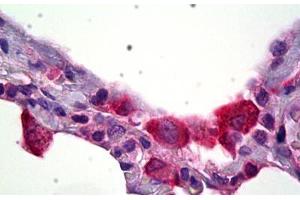 Anti-HSD11B1 antibody IHC staining of human lung, macrophages. (HSD11B1 抗体)
