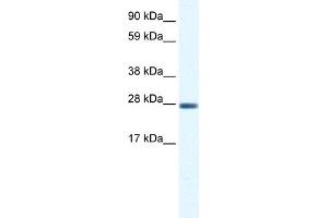 WB Suggested Anti-CLIC1 Antibody Titration:  0. (CLIC1 抗体  (C-Term))