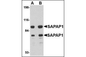 Western blot analysis of SAPAP1 in rat brain tissue lysate with this product at (A) 0. (DLGAP1 抗体  (Center))