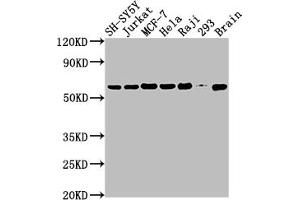 Western Blot Positive WB detected in: SH-SY5Y whole cell lysate, Jurkat whole cell lysate, MCF-7 whole cell lysate, Hela whole cell lysate, Raji whole cell lysate, 293 whole cell lysate, Mouse brain tissue All lanes: PKM antibody at 1:2000 Secondary Goat polyclonal to rabbit IgG at 1/50000 dilution Predicted band size: 58, 59, 57 kDa Observed band size: 58 kDa (Recombinant PKM 抗体)