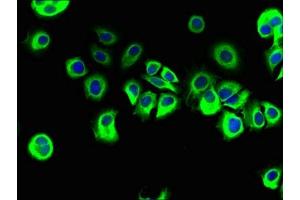 Immunofluorescent analysis of MCF-7 cells using ABIN7167443 at dilution of 1:100 and Alexa Fluor 488-congugated AffiniPure Goat Anti-Rabbit IgG(H+L) (REEP3 抗体  (AA 80-255))