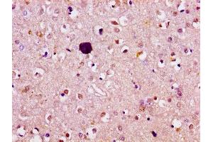 IHC image of ABIN7144809 diluted at 1:100 and staining in paraffin-embedded human brain tissue performed on a Leica BondTM system. (ATL1 抗体  (AA 220-350))
