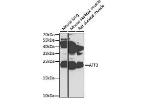 Western blot analysis of extracts of various cell lines, using  antibody (ABIN3023657, ABIN3023658, ABIN3023659, ABIN1678765 and ABIN6218982) at 1:1000 dilution. (ATF3 抗体  (AA 1-181))
