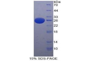 SDS-PAGE analysis of Human PAFAH1B3 Protein. (PAFAH1B3 蛋白)