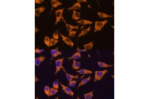 Immunofluorescence (IF) image for anti-CaM Kinase-Like Vesicle-Associated (CAMKV) (AA 1-285) antibody (ABIN7266051)