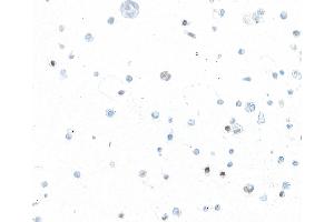 Immunocytochemistry (ICC) image for anti-Forkhead Box P3 (FOXP3) (AA 275-325) antibody (ABIN7795681)
