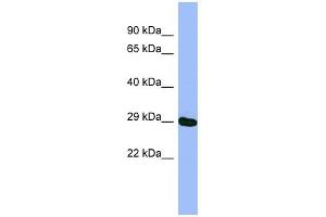 METTL5 antibody used at 1 ug/ml to detect target protein.